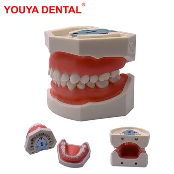 Zuby Model Pre Zubný Technik Praxi Typodont Model Guma S Vymeniteľné Zub Stomatológia Výučby Štúdium Odbornej Prípravy Produktov